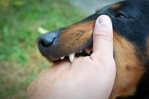 ARIZONA DOG BITE LAWS: WHAT SHOULD YOU DO IF A DOG BITES YOU?